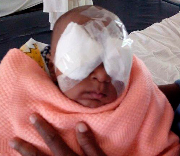 Right to Sight